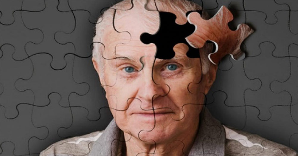 La Enfermedad de Alzheimer. ¿Es el precio de una larga vida?