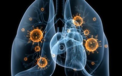 Avance español contra el cáncer de pulmón: hacen curable un tipo de tumor letal